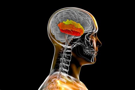 Understanding Wet Brain Orlando Treatment Solutions Florida