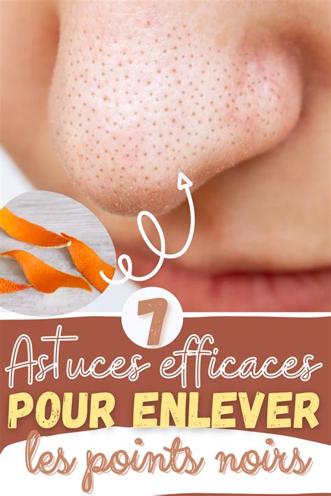 7 Astuces Efficaces Pour Enlever Les Points Noirs Artofit