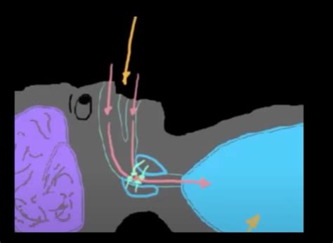 Sleep Consciousness Part Breathing Related Sleep Disorders