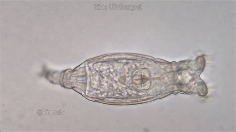 Rotifer Showing Its Cilia Crown Rotifer Under A Microscope Youtube