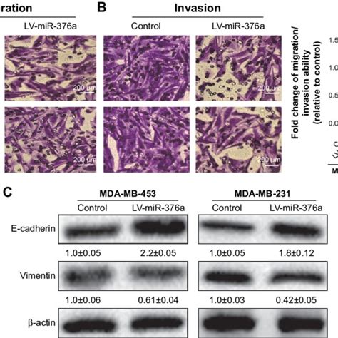 Mir 376a Overexpression Suppresses Breast Cancer Cells Migration