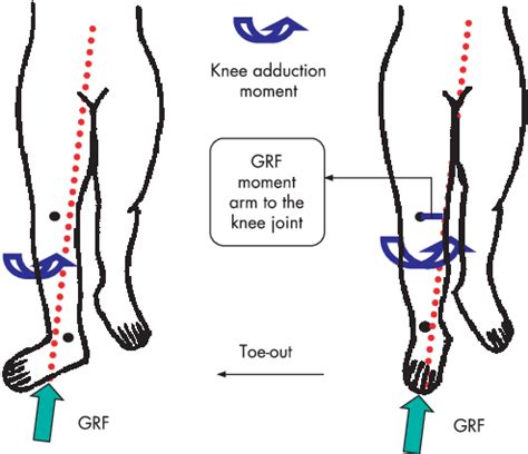 Out Toeing During Walking Shifts The Ground Reaction Force GRF Vector