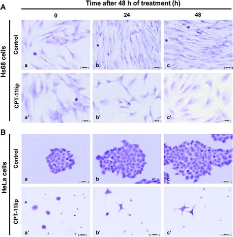 Morphological Changes After Treatment Cell Morphology Visualized By