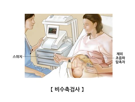 비수축검사 검사시술수술정보 의료정보 건강정보 서울아산병원