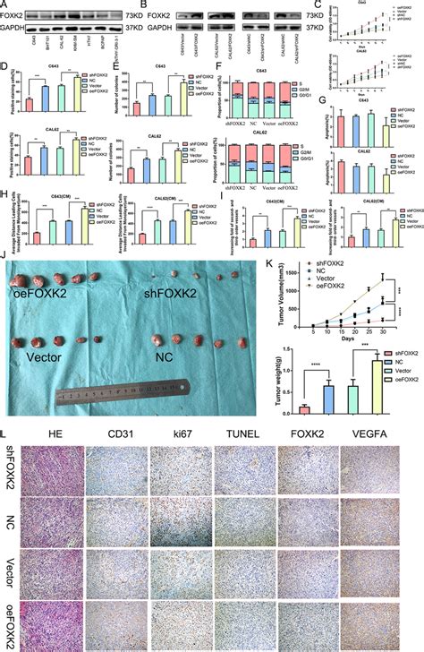 Foxk2 Induced Proliferation And Angiogenesis Via Vegfa In Atc In