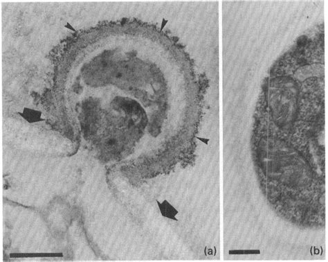 Anionic Groups At The Surface Of P Brasiliensis A A Mature Yeast