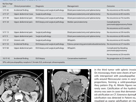 Table From Solid Pseudopapillary Neoplasm Of The Pancreas Ct Imaging