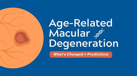 Age Related Macular Degeneration Archives Guideline Central