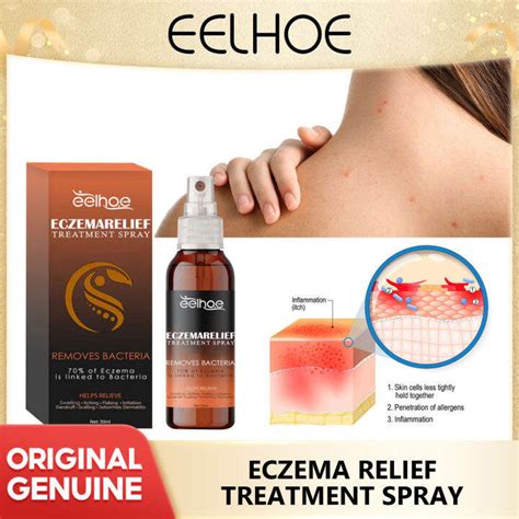 Eelhoe Inhibit Psoriasis Spray Eczema Urticaria Rash Allergies Cure