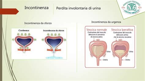 Riabilitazione Del Pavimento Pelvico PPT