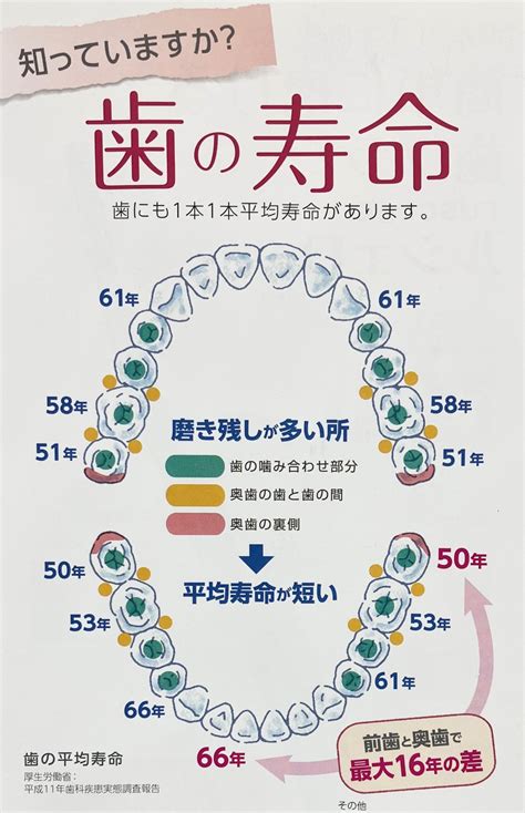 歯の寿命 錦糸町駅より徒歩9分｜墨田区太平の歯医者、錦糸町ミント歯科クリニック｜ブログ