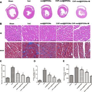 Regression Of Cardiac Hypertrophy And Myocardial Fibrosis In