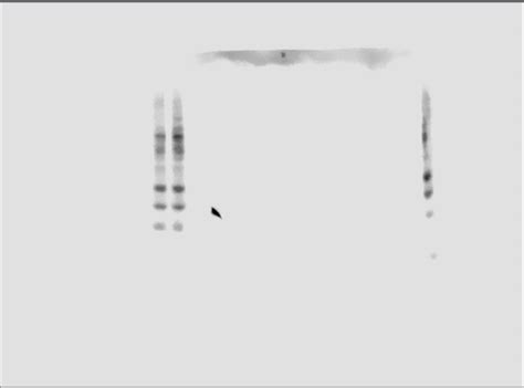 306 questions with answers in GAPDH | Science topic