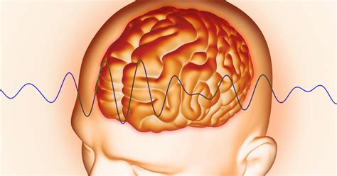Tipos De Ondas Cerebrales Delta Theta Alfa Beta Y Gamma