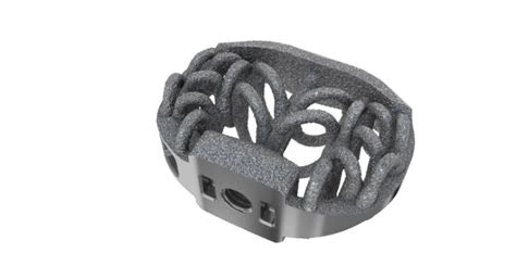 Fda Clears Camber Spine Technologies D Printed Spira Open Matrix Alif