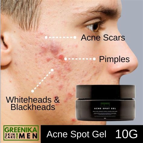 Greenika For Men Acne Spot Gel Anti Acne Pimple Treatment Lazada Ph