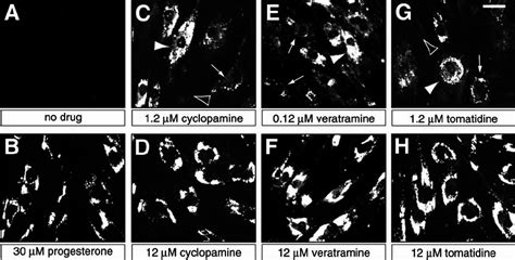 Accumulation Of Lipoprotein Derived Cholesterol In Lysosomes Of