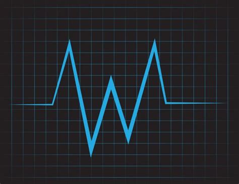 169 Electric Cardiogram Vector Images Depositphotos