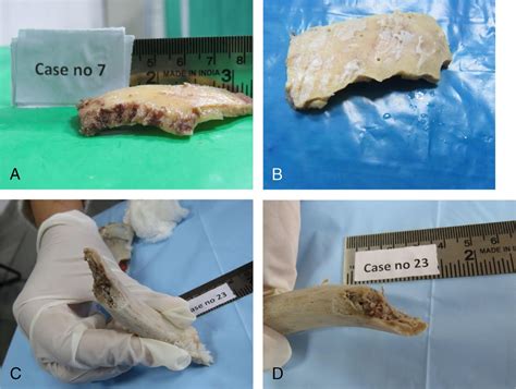 The American Journal Of Forensic Medicine And Pathology