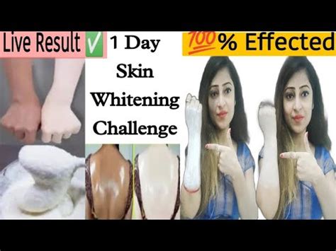 1Day Skin Whitening Challenge 100 Effected Skin Brightening Get