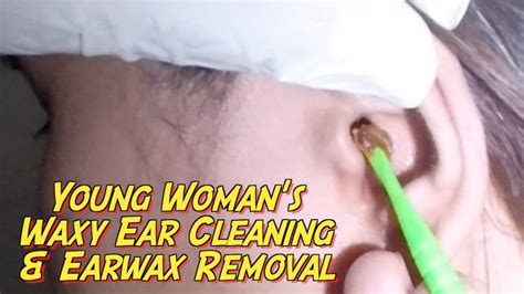 Young Womans Waxy Ear Cleaning And Earwax Removal Youtube