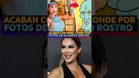 Acaban Con Ninel Conde Por Fotos De Su Nuevo Rostro Ninelconde