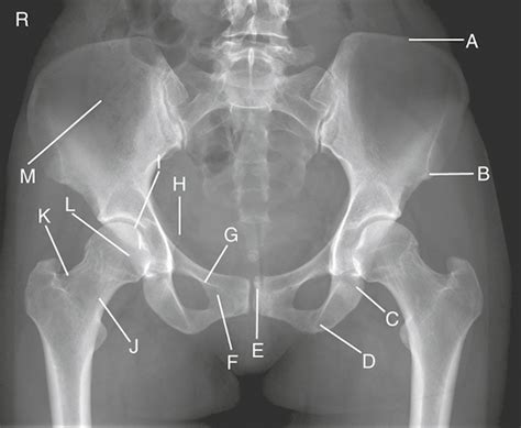 Ap Pelvis Anatomy Diagram Quizlet