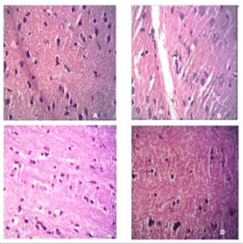 Histopathology of mice brain after treatment. Figure 4.A Histologically ... 