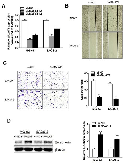 Knockdown Of MALAT1 Promoted Osteosarcoma Cell Migration And Invasion