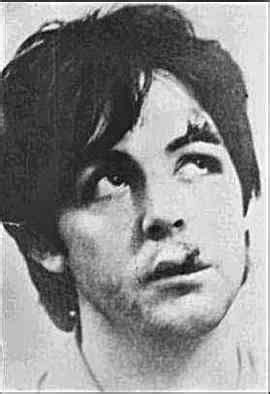 Car Accident: Paul Mccartney Car Accident 1966 Photos