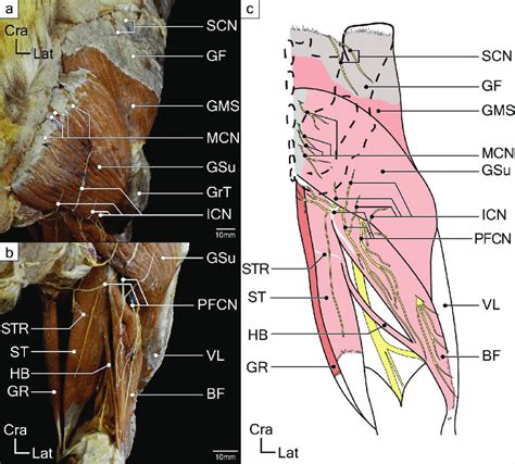 Superficial layer muscles of gluteal and posterior femoral regions in a ...