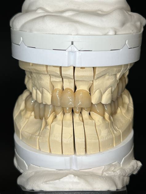 Für Patienten Quantum Dental