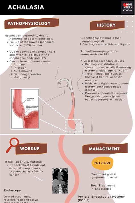 Achalasia — The Intern At Work