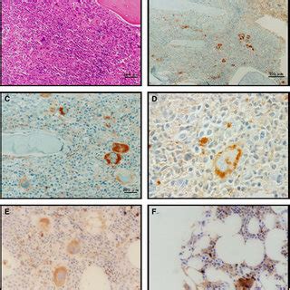 Serum Growth Differentiation Factor Gdf Levels In Patients With