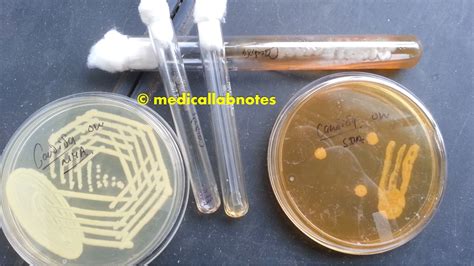 Germ Tube Test Introduction Principle Procedure Result