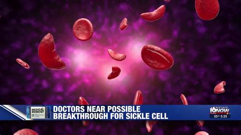 Medical Moment Doctors Near Possible Breakthrough For Sickle Cell