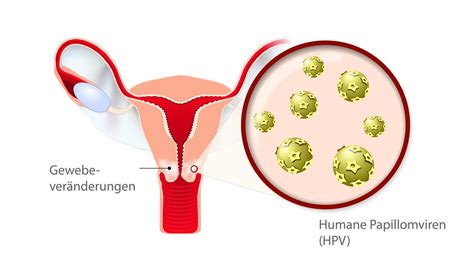 Pap Test Vorstufen Von Geb Rmutterhalskrebs Erkennen