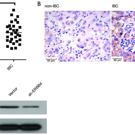 The Expression Of PDGFRA Was Regulated By ERBB4 A B PDGFRA