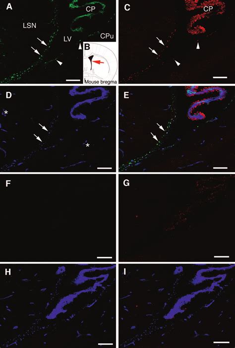 Fibroblast Growth Factor Fgf Binding To Fractones Depends On