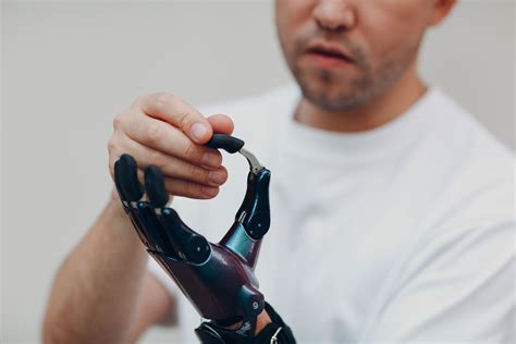 Upper Extremity Prosthetics Comprehensive Prosthetics And Orthotics