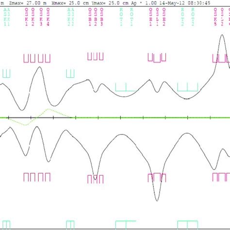 Transport Second Order Beam Envelope Of The Complete πe3 Beam Line The