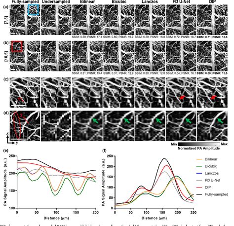 Figure From Deep Image Prior For Undersampling High Speed