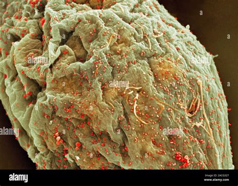 Cell Infected With Hiv Coloured Scanning Electron Micrograph Sem Of