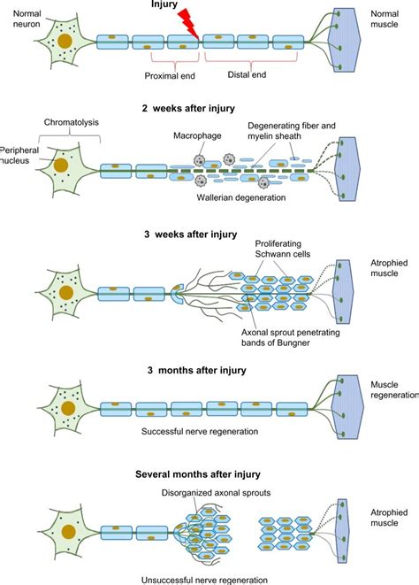 Cellular Responses To Nerve Injury Nerve Degeneration And Regeneration