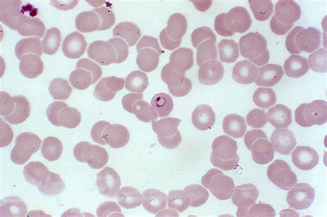 Free picture: parasites, may, mature, erythrocytic, schizont, gametocytes