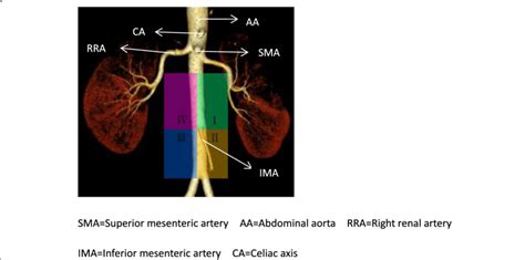 Schematic Diagram Of The Anatomical Distribution Of The Para Aortic