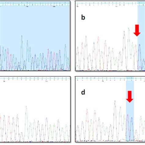 Sequence Chromatograms Of The Egfr Gene Mutations Located In The Exons