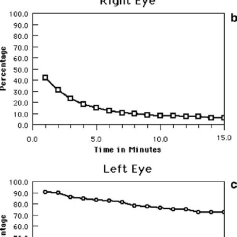 Specimen Scans From A Patient With Severe Epiphora Of The Left Eye A