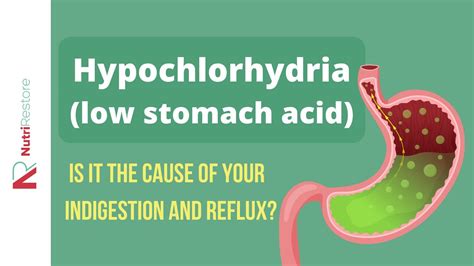 Hypochlorhydria (low stomach acid): Is it the cause of your indigestion and reflux? - YouTube