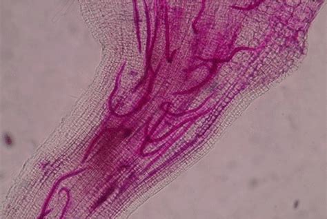 Second Stage Juveniles J2 Of Root Knot Nematode Inside Of A Root